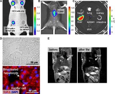 Functional delivery of DNAzyme with iron oxide nanoparticles for hepatitis C virus gene knockdown — 대표 그림